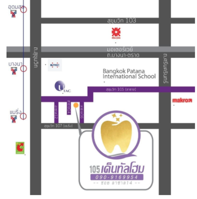 105 เด็นทัลโฮม - จัดฟัน 1500 บาท ซอยลาซาล14
