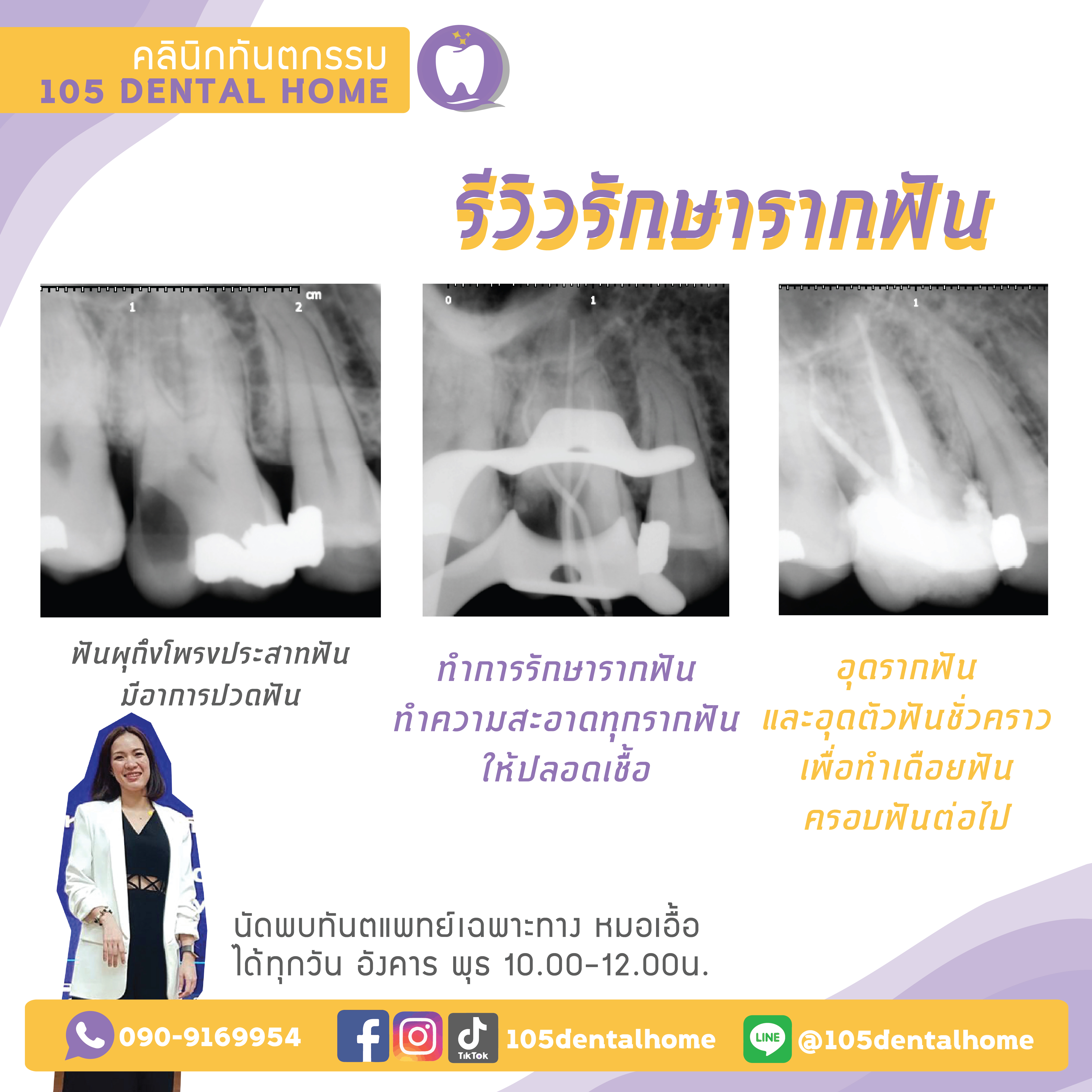 รักษารากฟัน