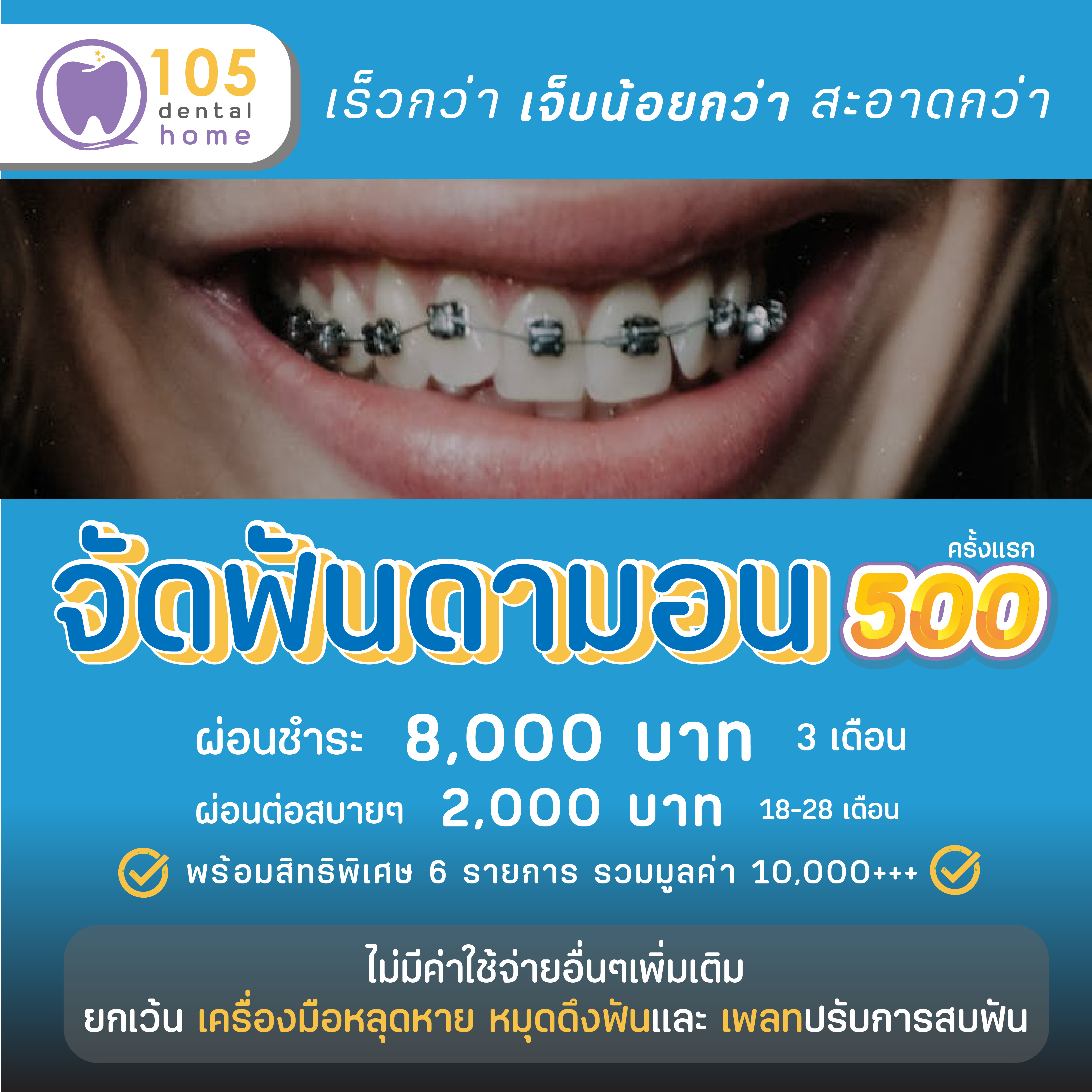 โปรโมชัน จัดฟันDamon